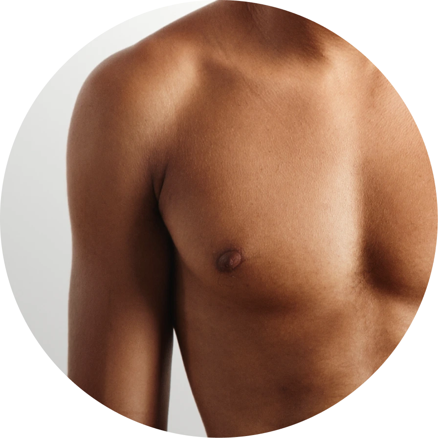 Gynecomas﻿tia Banner