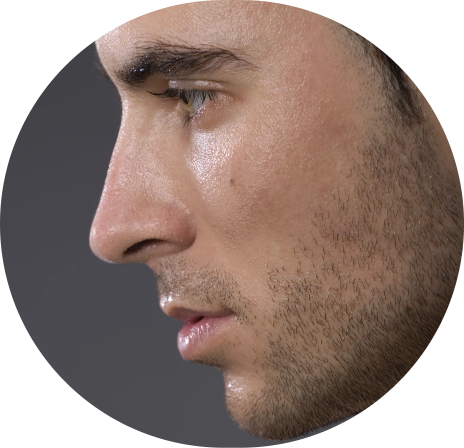 M﻿ale Rhinoplasty Banner
