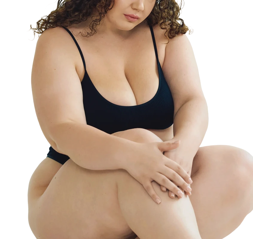 Lipedema Correction in Los Angeles, CA Banner